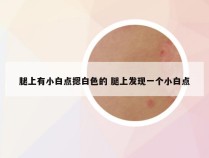 腿上有小白点摁白色的 腿上发现一个小白点