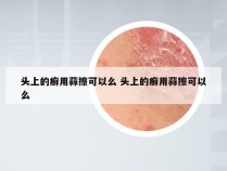 头上的癣用蒜擦可以么 头上的癣用蒜擦可以么