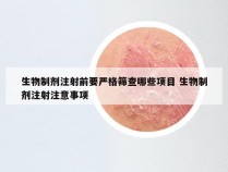 生物制剂注射前要严格筛查哪些项目 生物制剂注射注意事项