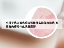 小孩子头上长头癣应该用什么洗发水洗头 儿童有头癣用什么洗发露好