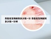 昂他克生物制剂多少钱一针 昂他克生物制剂多少钱一针啊