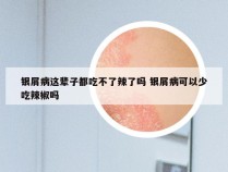 银屑病这辈子都吃不了辣了吗 银屑病可以少吃辣椒吗