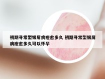 初期寻常型银屑病痊愈多久 初期寻常型银屑病痊愈多久可以怀孕