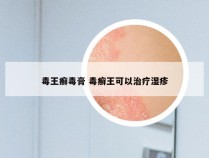 毒王癣毒膏 毒癣王可以治疗湿疹