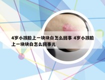 4岁小孩脸上一块块白怎么回事 4岁小孩脸上一块块白怎么回事儿