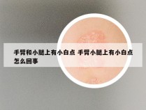 手臂和小腿上有小白点 手臂小腿上有小白点怎么回事