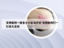 生物制剂一般多少针能治疗好 生物制剂打一针多久生效