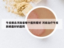 牛皮癣去河南省哪个医院看好 河南治疗牛皮肤癣最好的医院