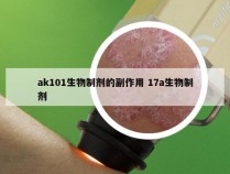 ak101生物制剂的副作用 17a生物制剂