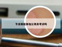 牛皮癣能参加公务员考试吗