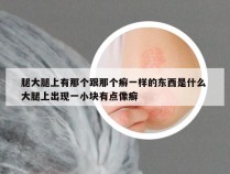 腿大腿上有那个跟那个癣一样的东西是什么 大腿上出现一小块有点像癣