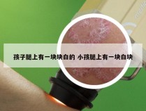 孩子腿上有一块块白的 小孩腿上有一块白块