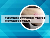 中国医学皮肤科学院皮肤病医院 中国医学皮肤科学院皮肤病医院怎么样