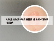 大剂量维生素D牛皮癣基因 维生素d衍生物 银屑病