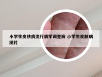 小学生皮肤病流行病学调查癣 小学生皮肤病图片