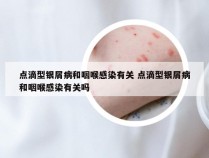 点滴型银屑病和咽喉感染有关 点滴型银屑病和咽喉感染有关吗