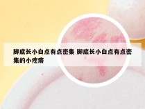 脚底长小白点有点密集 脚底长小白点有点密集的小疙瘩