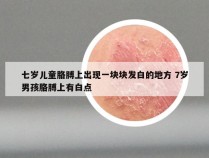 七岁儿童胳膊上出现一块块发白的地方 7岁男孩胳膊上有白点