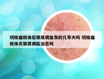 切除扁桃体后银屑病复发的几率大吗 切除扁桃体炎银屑病能治愈吗