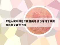 年轻人可以得老年银屑病吗 青少年得了银屑病这辈子就完了吗