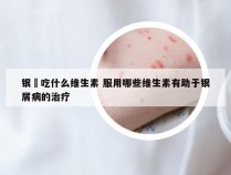 银痟吃什么维生素 服用哪些维生素有助于银屑病的治疗