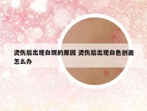 烫伤后出现白斑的原因 烫伤后出现白色创面怎么办