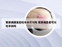 银屑病康复后吃羊肉可以吗 银屑病患者可以吃羊肉吗