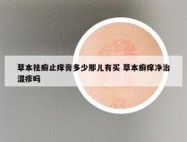 草本祛癣止痒膏多少那儿有买 草本癣痒净治湿疹吗