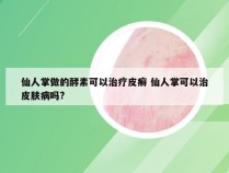 仙人掌做的酵素可以治疗皮癣 仙人掌可以治皮肤病吗?