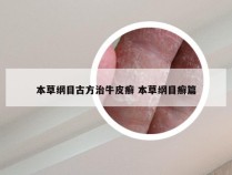 本草纲目古方治牛皮癣 本草纲目癣篇