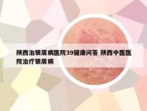 陕西治银屑病医院39健康问答 陕西中医医院治疗银屑病