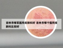 吉林市哪家医院皮肤科好 吉林市哪个医院皮肤科比较好