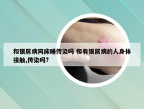 和银屑病同床睡传染吗 和有银屑病的人身体接触,传染吗?