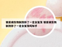 银屑病生物制剂停了一定会复发 银屑病生物制剂停了一定会复发吗知乎