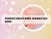 耳朵放血疗法能治牛皮癣吗 耳朵放血疗法治皮肤病