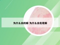 为什么会的癣 为什么会出现癣