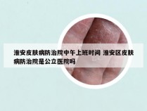 淮安皮肤病防治院中午上班时间 淮安区皮肤病防治院是公立医院吗