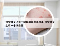 宝宝肚子上有一块白斑是怎么回事 宝宝肚子上有一小块白斑