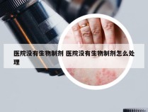 医院没有生物制剂 医院没有生物制剂怎么处理