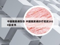 中国银屑病生存 中国银屑病诊疗现状2020蓝皮书