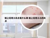 腿上出现小白点是什么病 腿上出现小小的白点