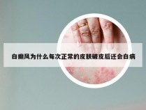 白癫风为什么每次正常的皮肤破皮后还会白病