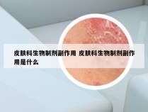 皮肤科生物制剂副作用 皮肤科生物制剂副作用是什么