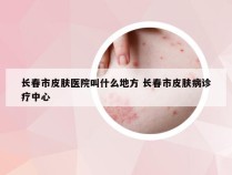 长春市皮肤医院叫什么地方 长春市皮肤病诊疗中心