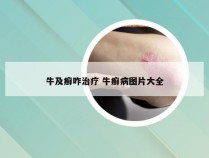 牛及癣咋治疗 牛癣病图片大全