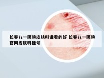 长春八一医院皮肤科谁看的好 长春八一医院官网皮肤科挂号