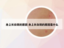 身上长白斑的原因 身上长白斑的原因是什么