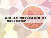 腿上黑一块白一块是什么原因 腿上黑一块白一块是什么原因引起的