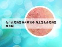 为什么无缘无故长癣秋冬 身上怎么会无缘无故长癣