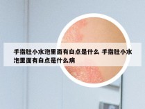 手指肚小水泡里面有白点是什么 手指肚小水泡里面有白点是什么病